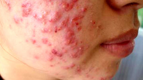 tác hại của kem trộn