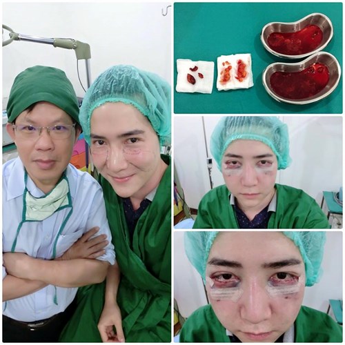 mặt biến dạng