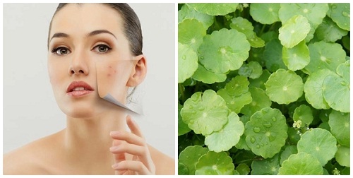 Hành Trình Dịu Nhẹ Cải Thiện Tàn Nhang - hình minh họa 3